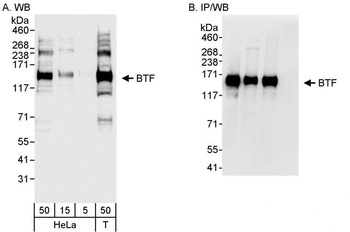 Rabbit anti-BTF Antibody, Affinity Purified
