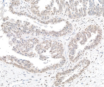 Rabbit anti-BTF Antibody, Affinity Purified