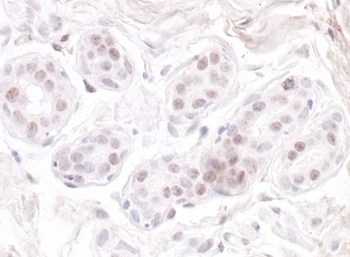 Rabbit anti-GNL3 Antibody, Affinity Purified