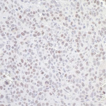 Rabbit anti-GNL3 Antibody, Affinity Purified