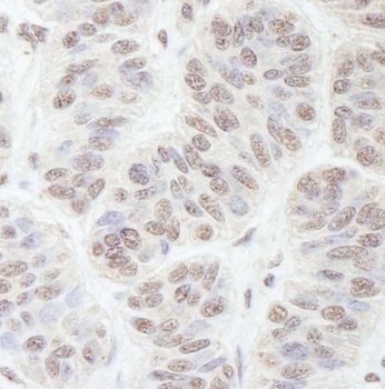 Rabbit anti-GNL3 Antibody, Affinity Purified