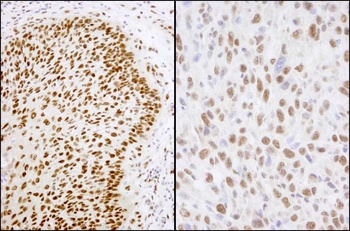 Rabbit anti-Matrin 3 Antibody, Affinity Purified