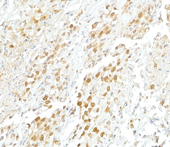 Rabbit anti-VCP Antibody, Affinity Purified