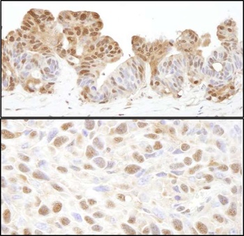 Rabbit anti-VCP Antibody, Affinity Purified