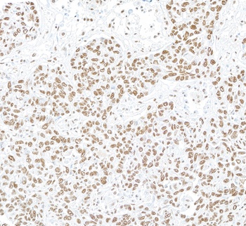 Rabbit anti-NONO Antibody, Affinity Purified