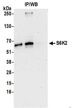 Rabbit anti-S6K2 Antibody, Affinity Purified