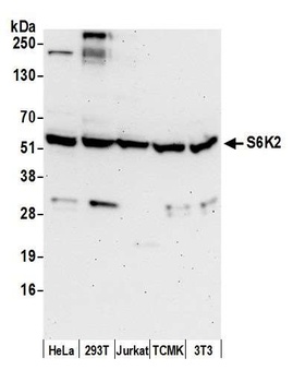 Rabbit anti-S6K2 Antibody, Affinity Purified