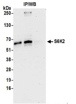 Rabbit anti-S6K2 Antibody, Affinity Purified