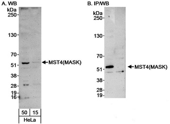Rabbit anti-MST4/MASK Antibody, Affinity Purified