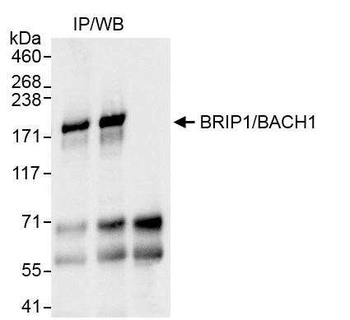 Rabbit anti-BRIP1/BACH1 Antibody, Affinity Purified