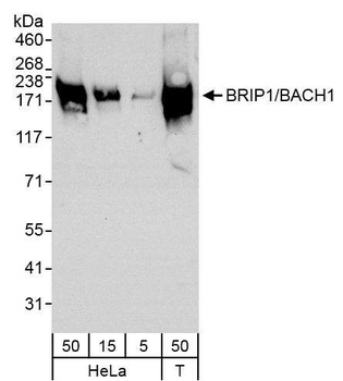 Rabbit anti-BRIP1/BACH1 Antibody, Affinity Purified