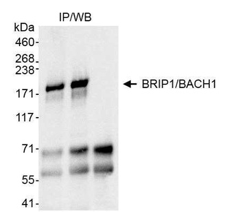 Rabbit anti-BRIP1/BACH1 Antibody, Affinity Purified