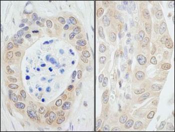 Rabbit anti-NMI Antibody, Affinity Purified