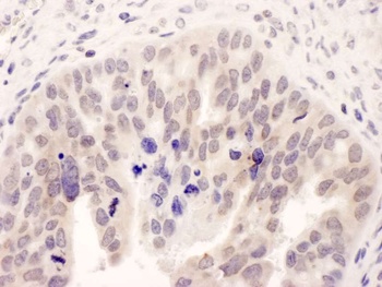 Rabbit anti-NMI Antibody, Affinity Purified