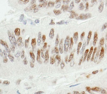 Rabbit anti-ZBTB7/FBI-1 Antibody, Affinity Purified