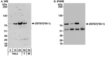Rabbit anti-ZBTB7/FBI-1 Antibody, Affinity Purified