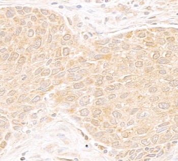 Rabbit anti-DDX19 Antibody, Affinity Purified