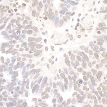 Rabbit anti-REST Antibody, Affinity Purified