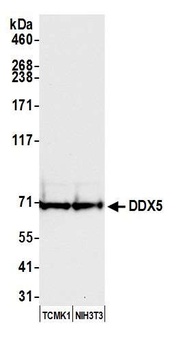 Rabbit anti-DDX5 Antibody, Affinity Purified