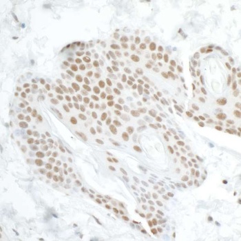 Rabbit anti-DDX5 Antibody, Affinity Purified