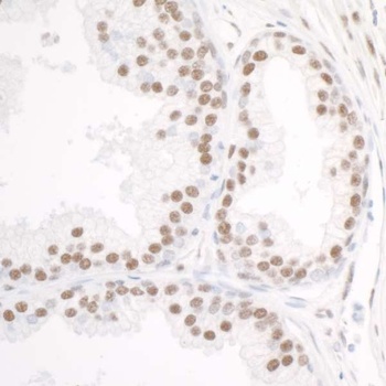 Rabbit anti-DDX5 Antibody, Affinity Purified