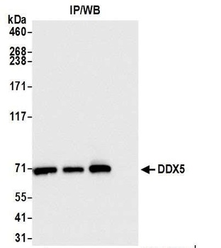 Rabbit anti-DDX5 Antibody, Affinity Purified