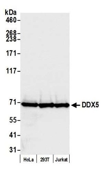 Rabbit anti-DDX5 Antibody, Affinity Purified