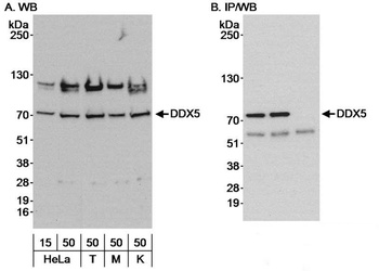 Rabbit anti-DDX5 Antibody, Affinity Purified