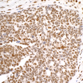 Rabbit anti-DDX1 Antibody, Affinity Purified