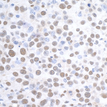 Rabbit anti-DDX1 Antibody, Affinity Purified