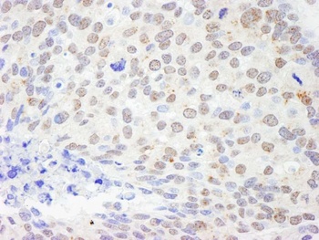 Rabbit anti-DDX1 Antibody, Affinity Purified