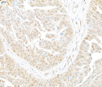 Rabbit anti-Lasu1/Ureb1 Antibody, Affinity Purified