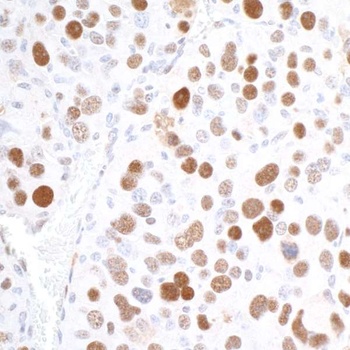 Rabbit anti-RCH1/KPNA2 Antibody, Affinity Purified