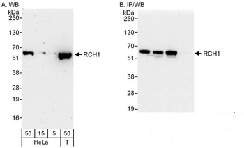 Rabbit anti-RCH1/KPNA2 Antibody, Affinity Purified
