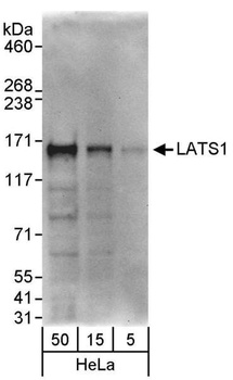 Rabbit anti-LATS1 Antibody, Affinity Purified