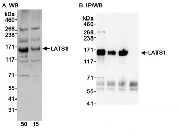 Rabbit anti-LATS1 Antibody, Affinity Purified