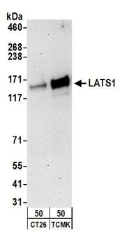 Rabbit anti-LATS1 Antibody, Affinity Purified