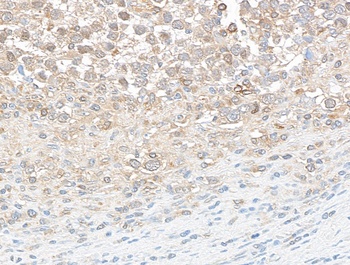 Rabbit anti-DDX3 Antibody, Affinity Purified