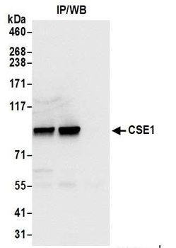 Rabbit anti-CSE1 Antibody, Affinity Purified