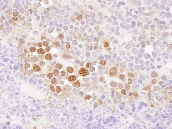 Rabbit anti-CSE1 Antibody, Affinity Purified
