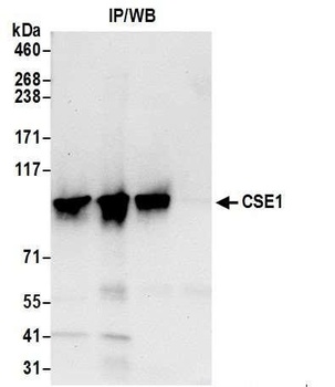 Rabbit anti-CSE1 Antibody, Affinity Purified