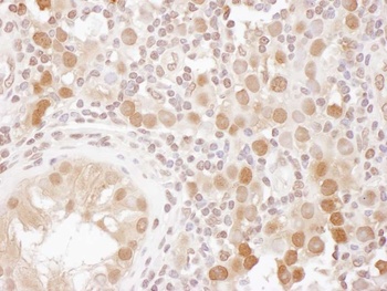Rabbit anti-CSE1 Antibody, Affinity Purified