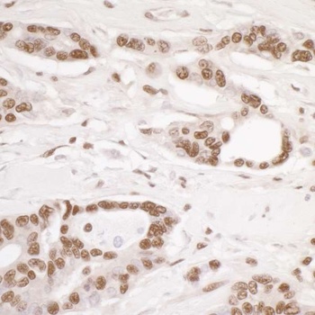 Rabbit anti-DDB1 Antibody, Affinity Purified