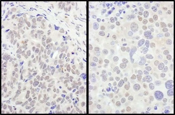 Rabbit anti-FOXO3a Antibody, Affinity Purified