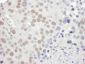 Rabbit anti-MSH2 Antibody, Affinity Purified