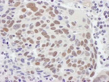 Rabbit anti-MSH2 Antibody, Affinity Purified