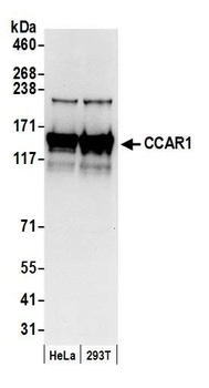 Rabbit anti-CCAR1 Antibody, Affinity Purified