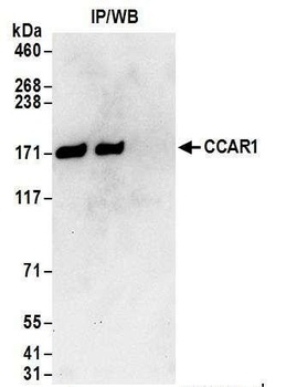 Rabbit anti-CCAR1 Antibody, Affinity Purified