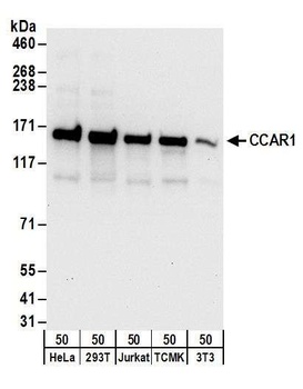 Rabbit anti-CCAR1 Antibody, Affinity Purified