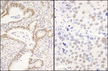 Rabbit anti-CCAR1 Antibody, Affinity Purified